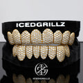 Double-Ice Honeycomb Pave Moissanite Grillz