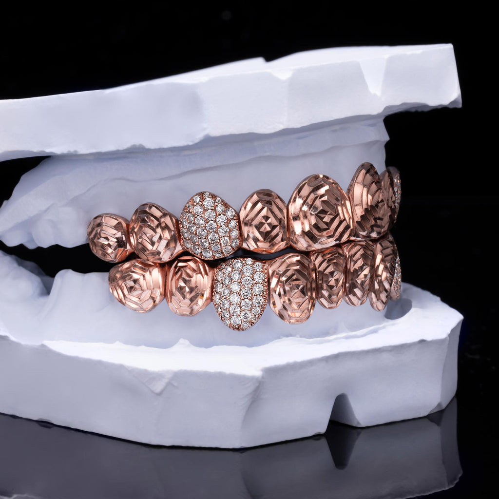 Iced Rose Cut & Pavé Hybrid Grillz