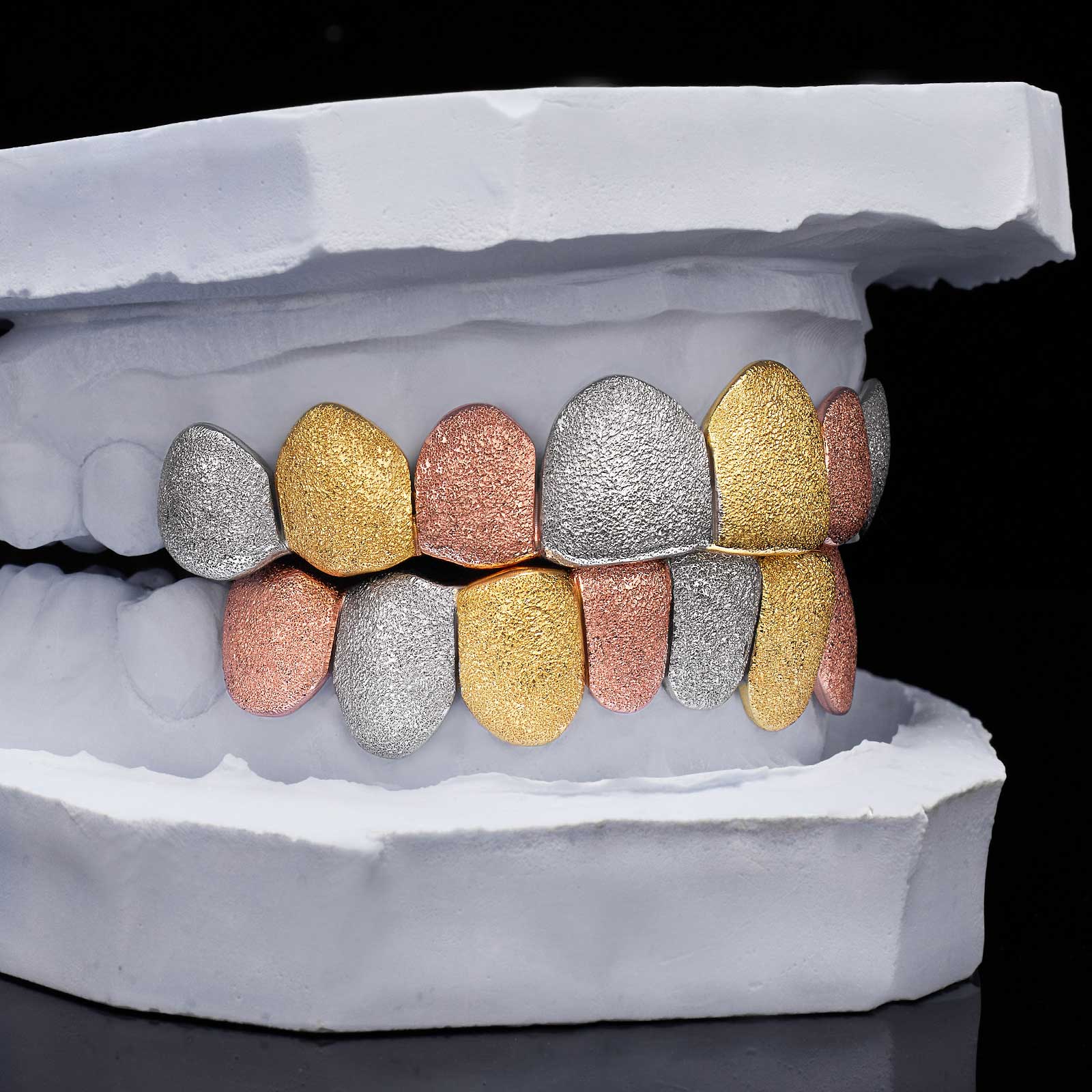 Multi-Tone Diamond Dust Custom Grillz