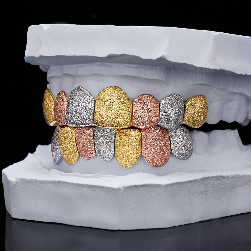 Multi-Tone Diamond Dust Custom Grillz