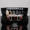 Opal Halo Iced Open Face Grillz