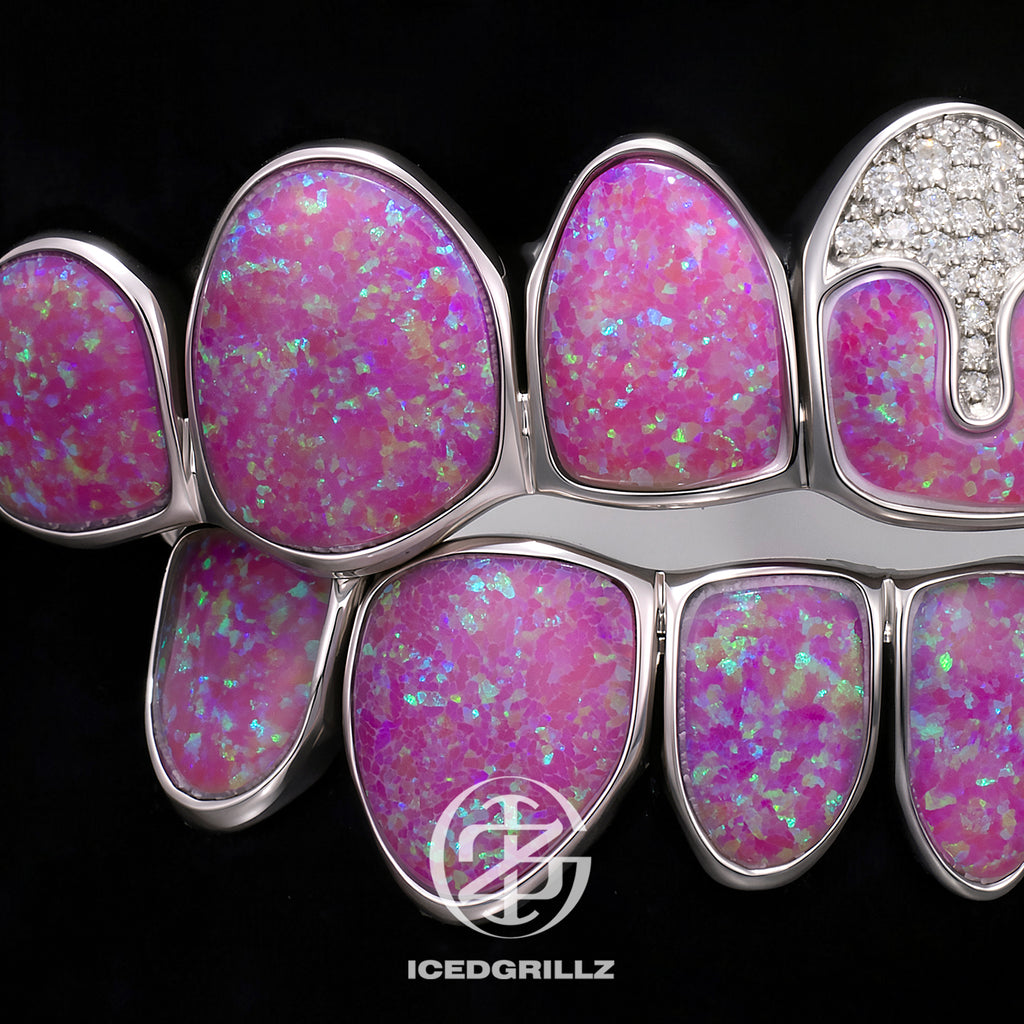 Opal Puzzle & Moissanite Honeycomb Grillz