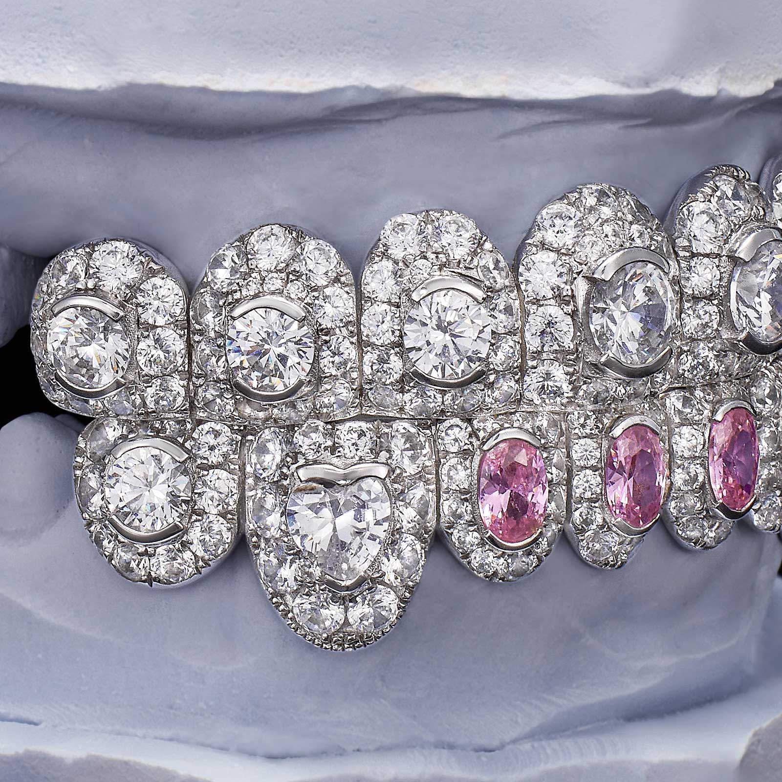 Pink Oval & Heart Cut Diamond Fang Grillz (Exotic Set)